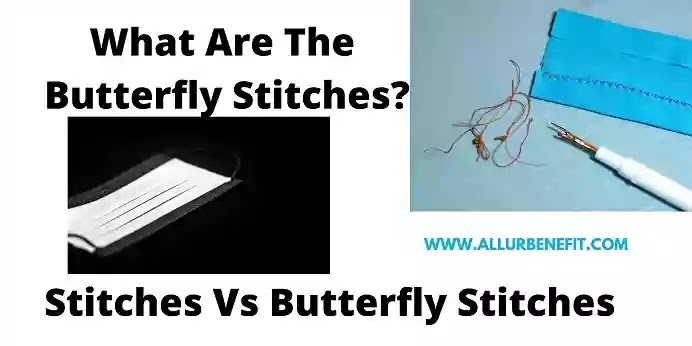 What Are Butterfly Stitches!! How To Apply Butterfly Stitches?