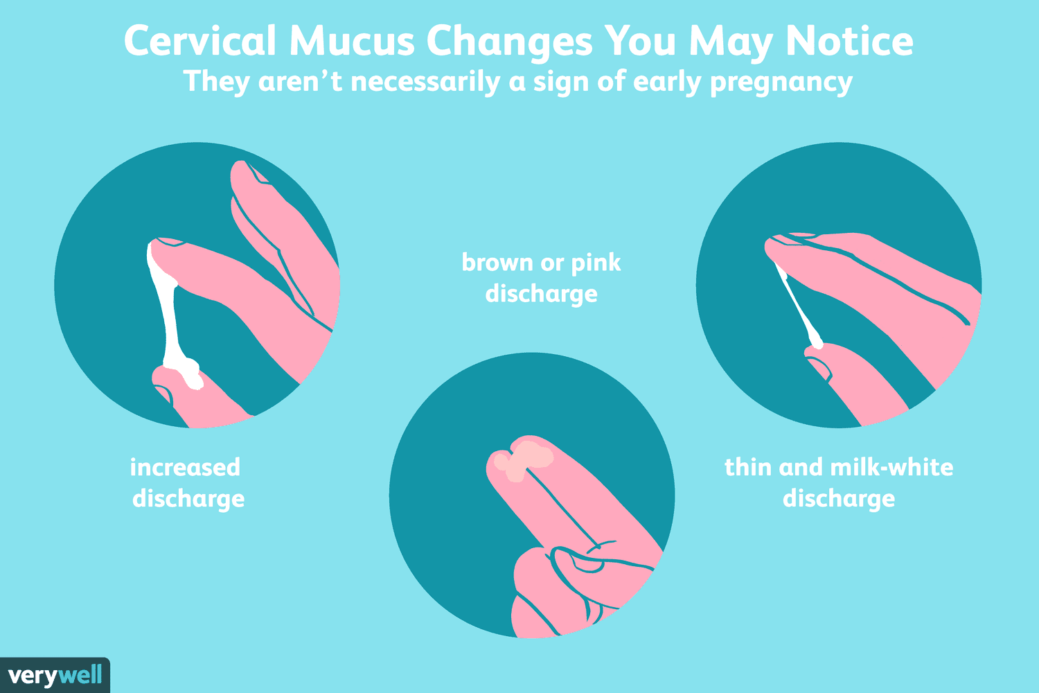 10 Types Of Vaginal Discharge That You Should Know