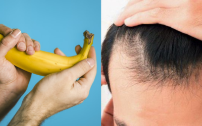 Masturbation Really Cause HAIR LOSS? With Scientific Reason